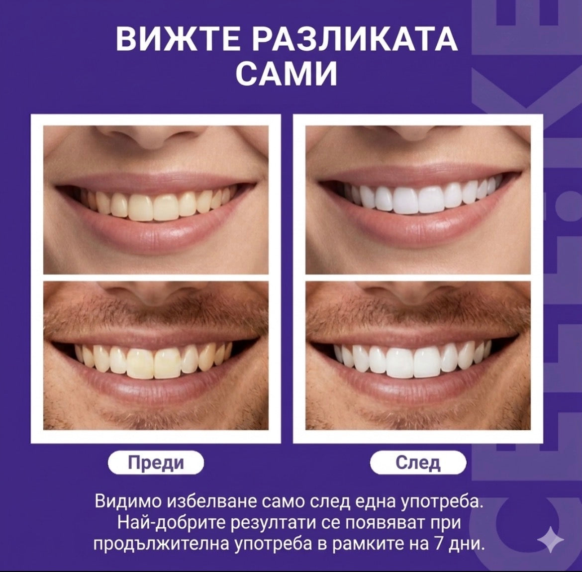 CEELIKE® Professional Teeth Whitening Kit